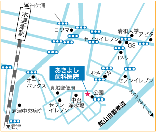 あきよし歯科医院 千葉県木更津市 木更津市歯科 小児歯科 口腔外科